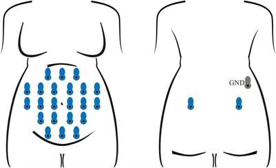 Automatic signal quality assessment of raw trans-abdominal biopotential recordings for non-invasive fetal electrocardiography